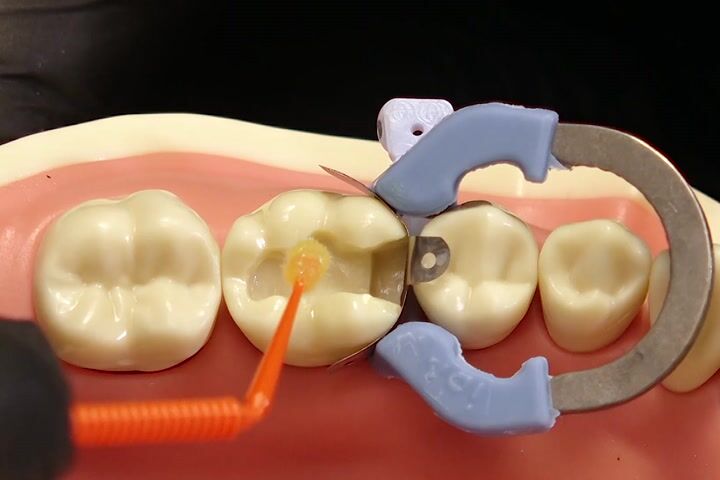 Scotchbond Universal Uygulama Rehberi