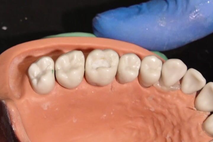 Direkt Restorasyonlarda El Aleti Seçimi