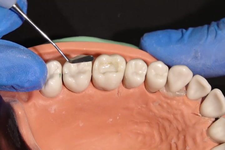 Anatomik Tabakalama Tekniği